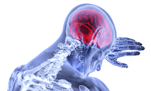Traumatic Brain Injury from a Motorcycle Accident